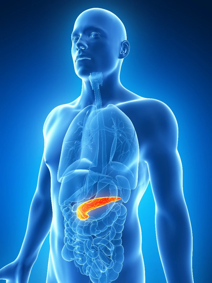 Reducing pancreatic fat can be highly effective in the treatment of diabetes