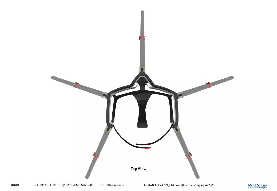 The production version of the Sports Walker would have telescoping legs, to adjust for the height of the user