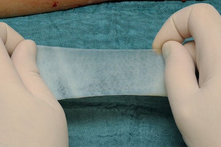 A sample of the burn-healing biomaterial