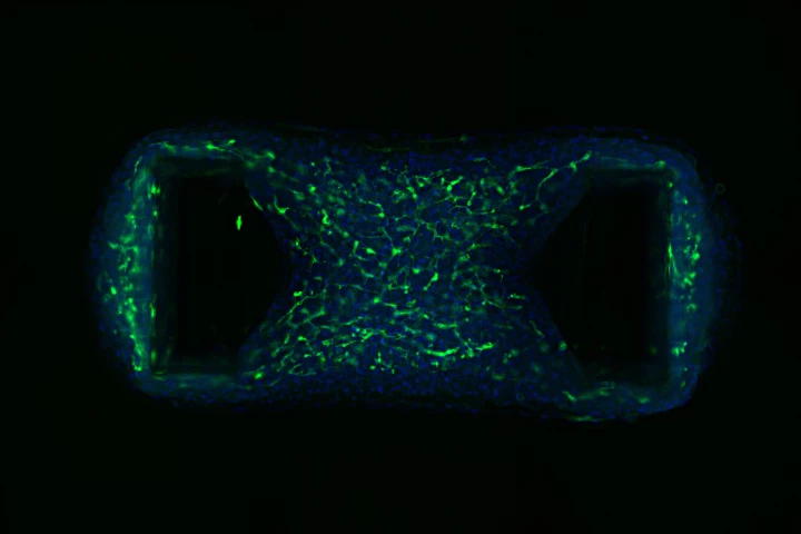 Australian researchers have created the first tiny heart with a vascular system, shown here in green