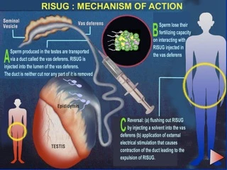 (Image: Male Contraception Information Project)