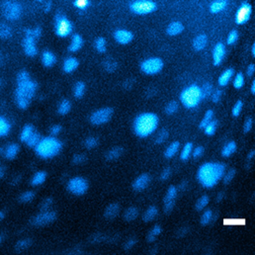 An image taken with the probe’s two-photon fluorescence microscope shows cells in a 70-micrometer thick piece of vocal cord from a pig (Image: Ben-Yakar Group, University of Texas at Austin)