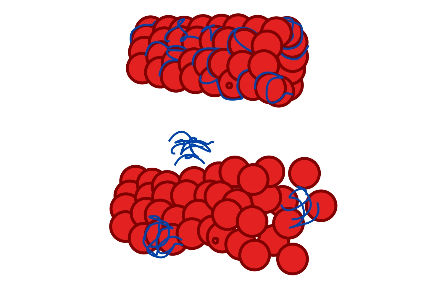 Tau proteins provide structural support for neural microtubules (top image). In tauopathy (bottom image), they clump to one another instead of to the neuron, causing it to degenerate