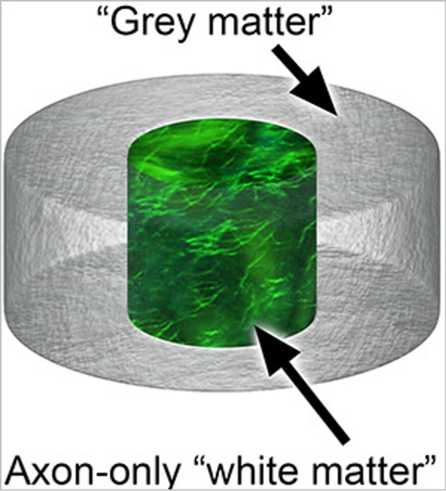 Diagram of scaffold donut showing grey-white matter compartmentalization