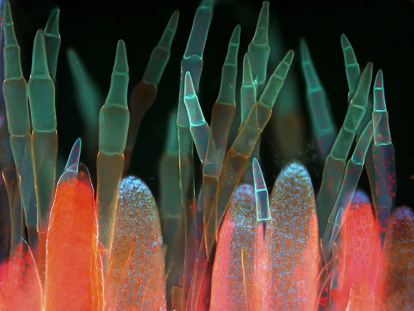 Image of Distinction: Bryum hornum (moss) antheridia (sex organ) and paraphyses (support structures)