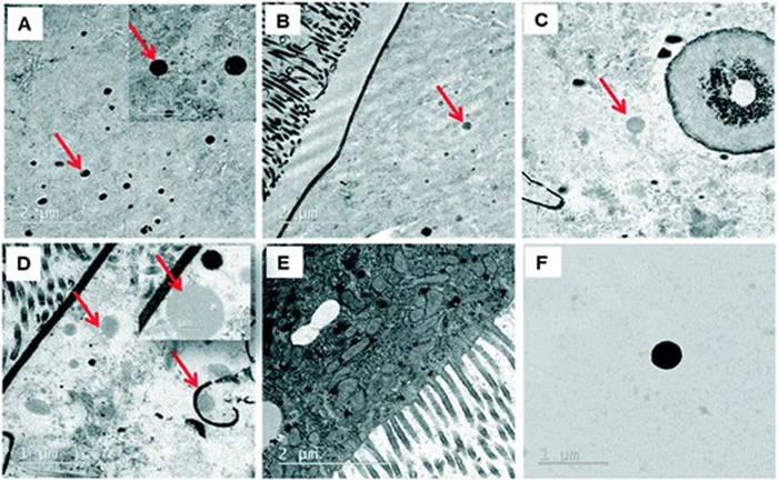 Images track the journey of plastic particles after ingestion by fruit flies, eventually winding up in the haemolymph, the equivalent to blood in humans