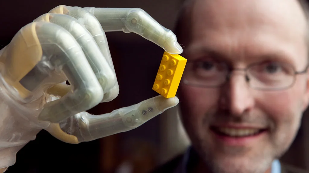 Eric Jones shows off his ProDigits bionic fingers