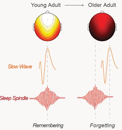 An illustration showing how the brainwaves of the young subjects sync up during sleep while older subjects fall out of sync resulting in less memories being consolidated successfully