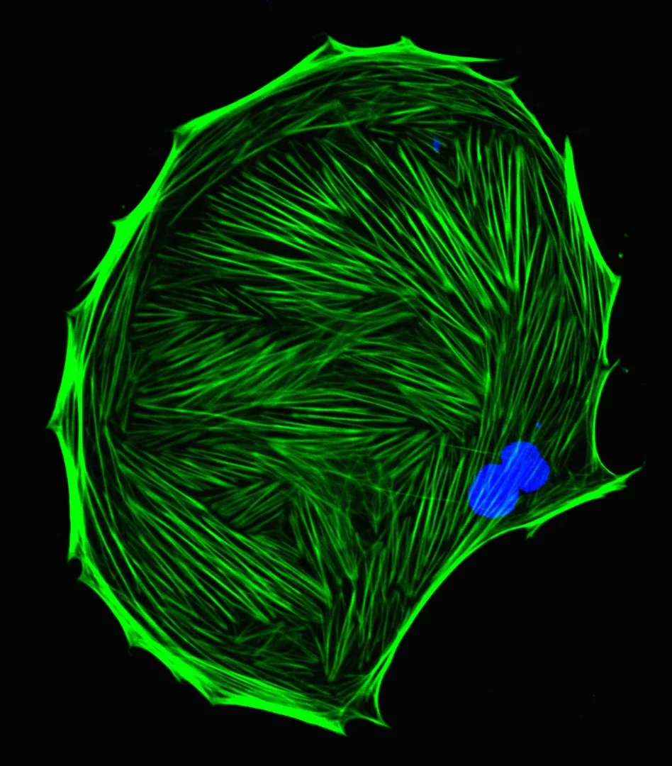 Image of Distinction: Actin cytoskeletal network inside a multi protoplasmic astrocyte