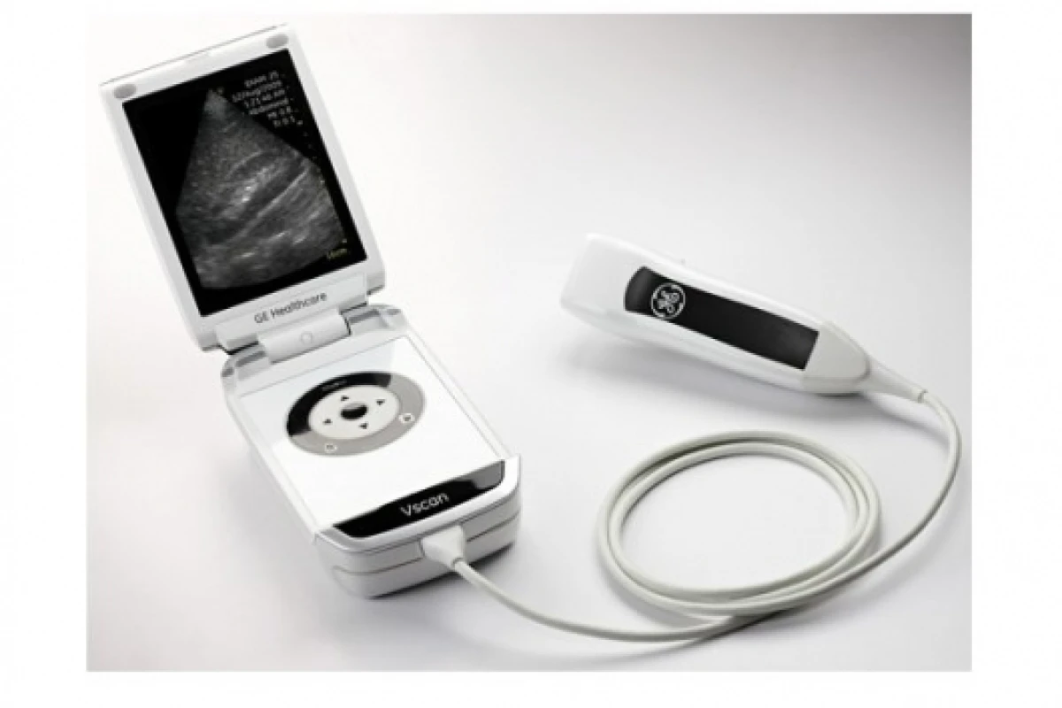 General Electric's new Vscan portable ultrasound scanner, possibly giving every physician Star Trek-like diagnostic capabilities