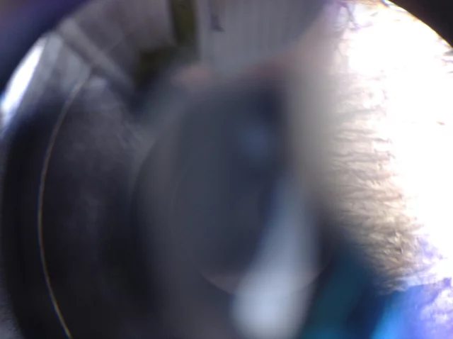 My attempt at shooting a tree WITHOUT the Snapzoom