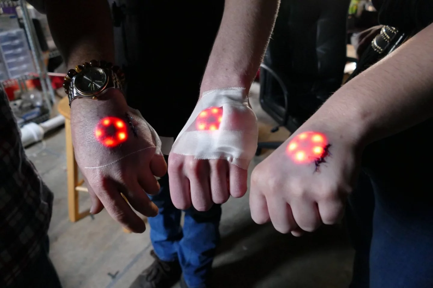 The first iteration of the Northstar, a glowing LED implant