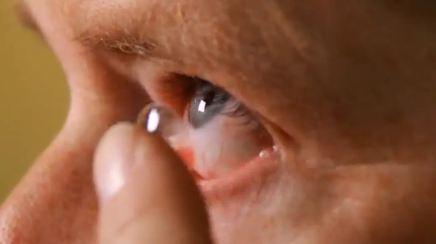 In the future, monitoring one's blood sugar may be as simple as popping in a contact lens