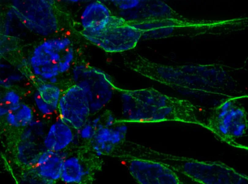 The exosomes (red) are being taken up by the nuclei (blue) of the neurons (green) in the brain of the stroke victims