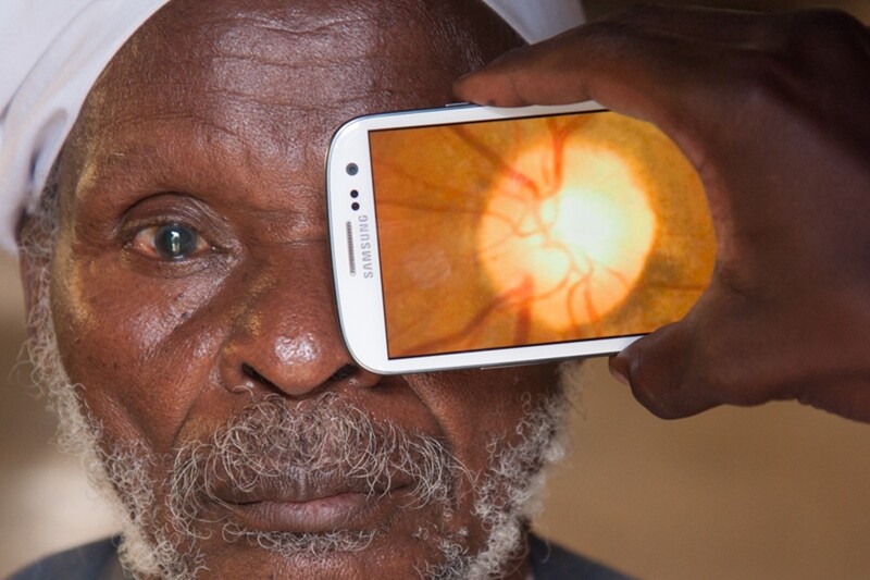 Retinal imaging using the Portable Eye Examination Kit (PEEK)