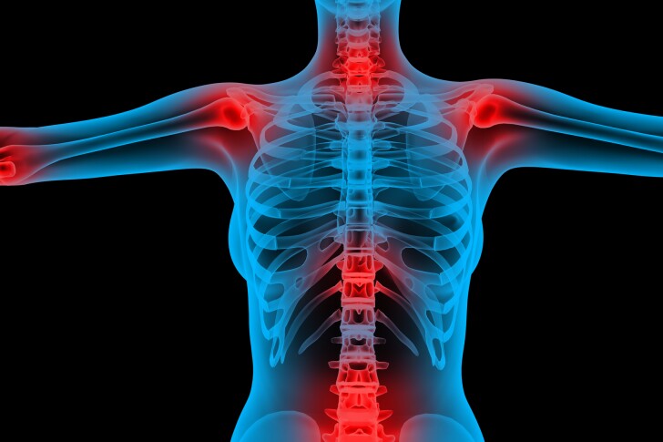 A new discovery around excessive cell death in the body offers new hope of treating conditions driven by chronic inflammation