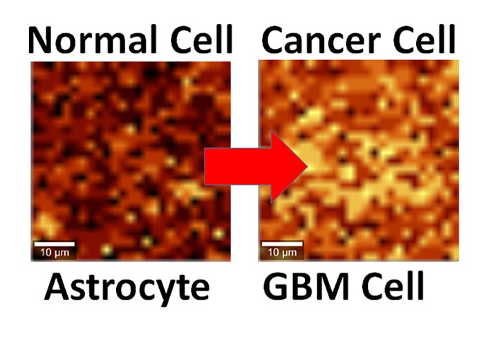 Normal and cancerous brain cells behave different when interfaced with graphene