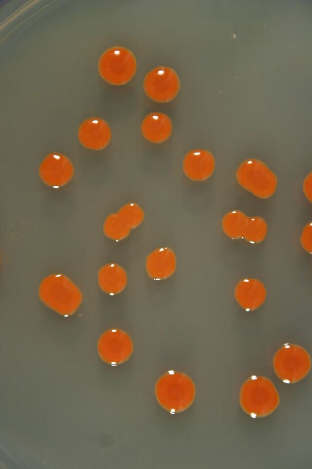 Sarcinaxanthin-producing bacteria on agar plates in the laboratory (Photo: Credit Geir Klinkenberg, SINTEF)