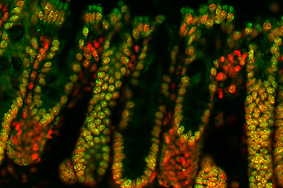 Cells in the lining of the mouse large intestine showing DNA in red and crotonylation in green