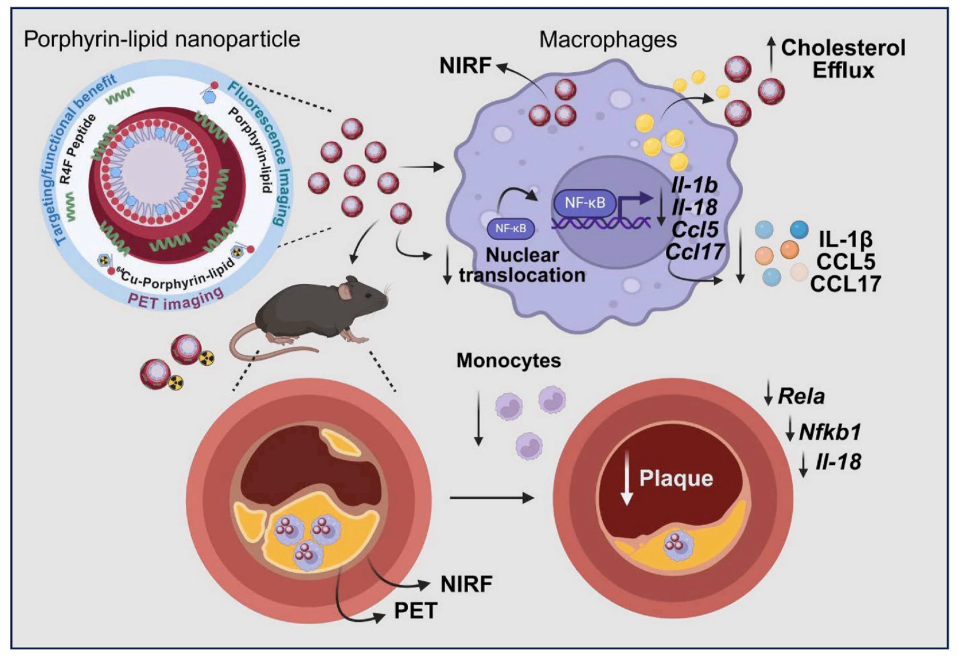 Esquema ilustrativo del uso de nanopartículas de porfirina-lípido para tratar la aterosclerosis en un modelo de ratón. Las nanopartículas son absorbidas por los macrófagos, promueven el eflujo de colesterol y reducen la expresión de genes inflamatorios, lo que lleva a una reducción de la placa en arterias. Se incluyen técnicas de imagen como NIRF y PET para seguimiento.
