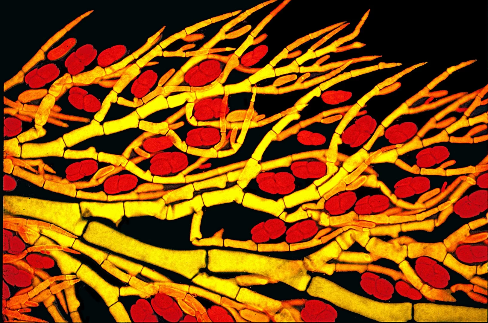 Image of Distinction: Antithamnionella (red algae) with tetra spores