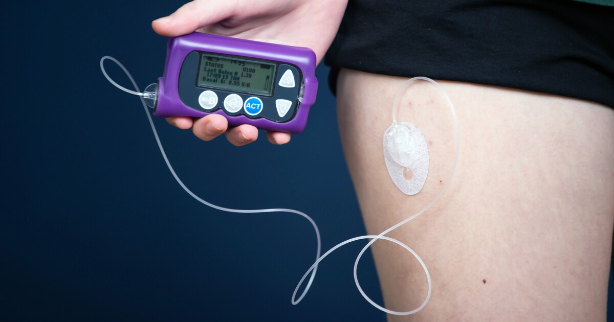 Transplant drug shows promise in slowing type 1 diabetes progression Transplant drug shows promise in slowing type 1 diabetes progression