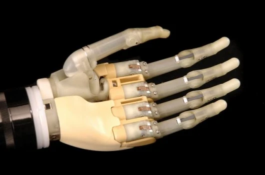 The iLimb hand, from Touch Bionics