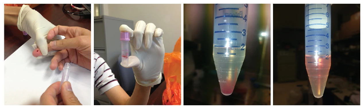 Schematic on finger-prick blood isolation and treatment for cellular reprogramming (Photo: Loh Yuin Han, Jonathan, IMCB)