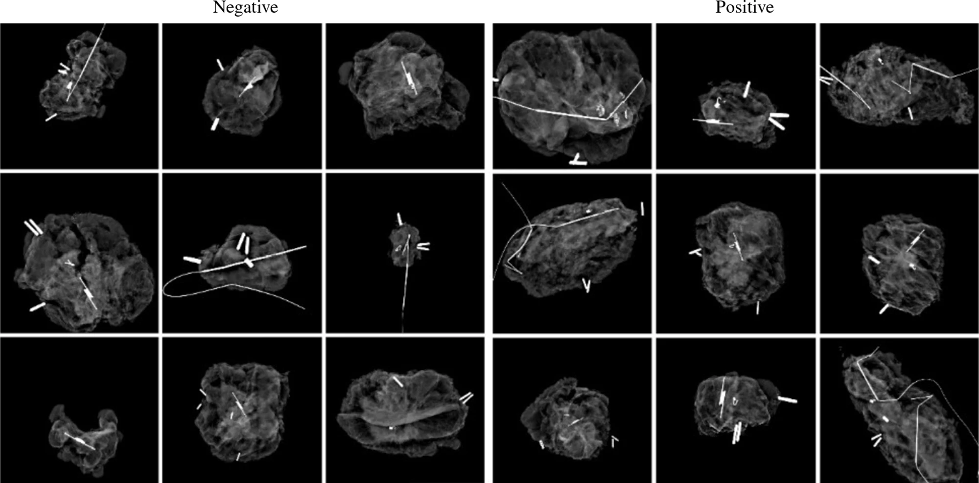 Examples of negative and positive specimen mammography images used to teach the AI model