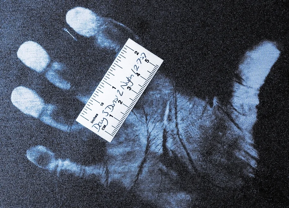Forensic researchers have had early success refining a method normally used to recover fingerprints from plastic and glass, and applying it to clothing