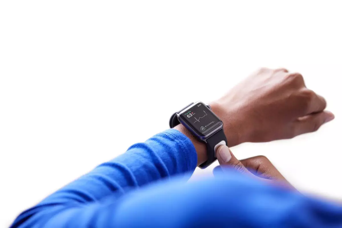 AliveCor’s KardiaBand is based on the same electrocardiogram (EKG) technology seen its earlier products