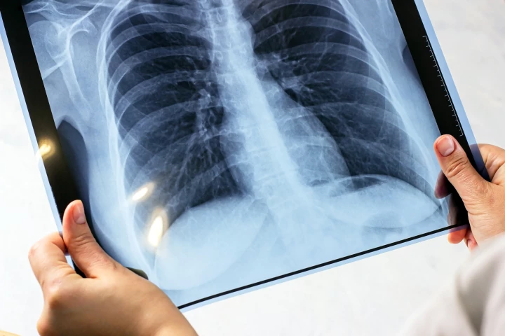 Researchers have developed a new printable X-ray detector that is highly sensitive and operates over a broad energy range, making it useful for a range of real-world applications