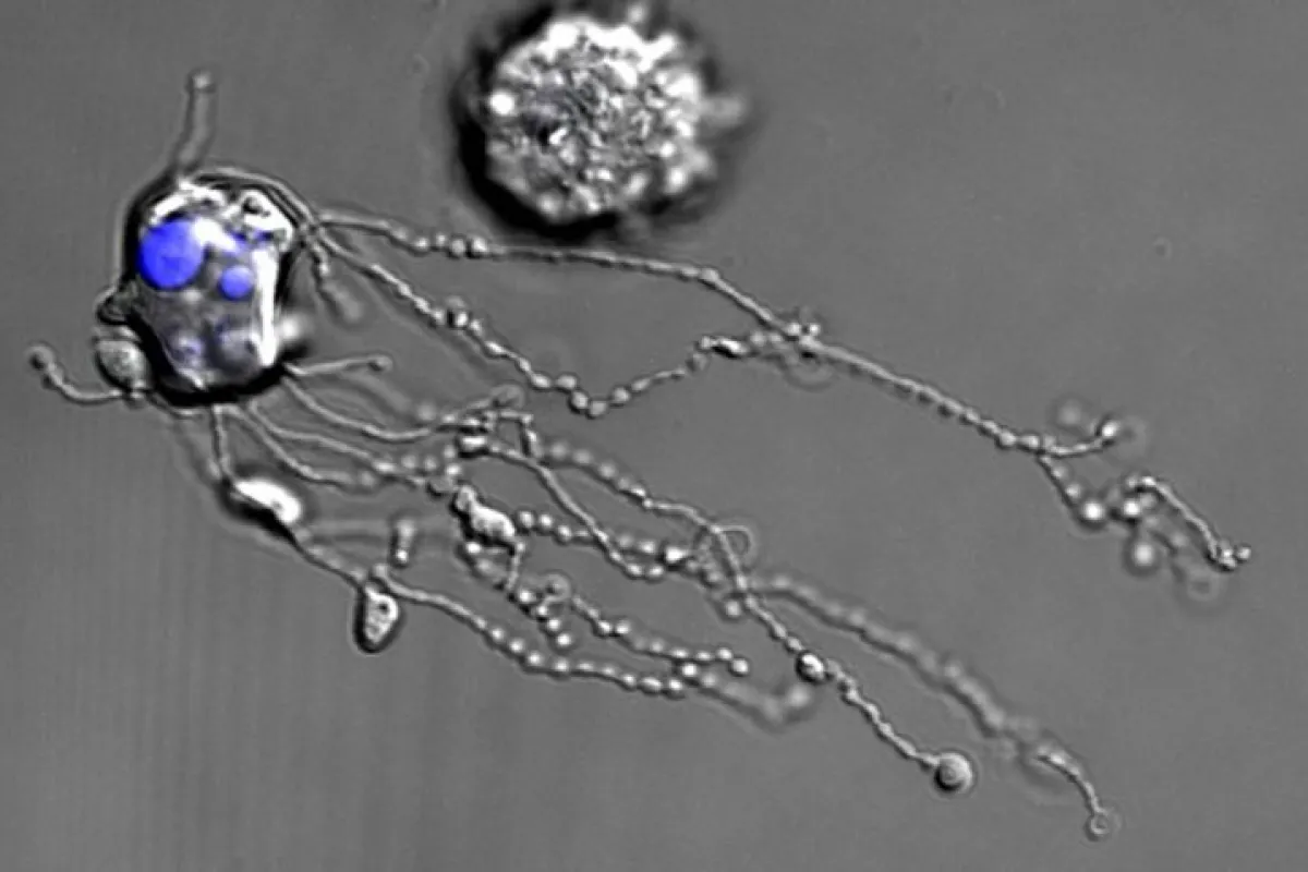 The first-of-its-kind video shows the white blood cells to eject a string of proteins as they die