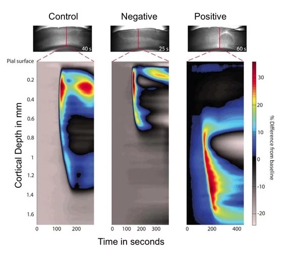 Optical images of the spreading depolarization in the brain
