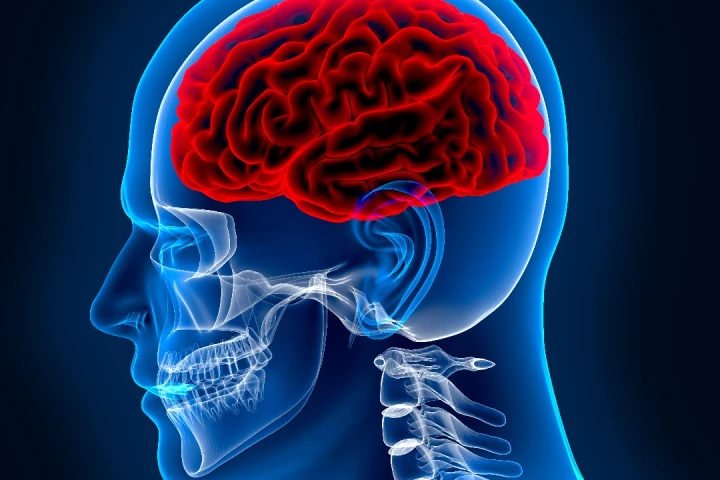 To check if someone is concussed, seeing how their brain responds to sound may be the way to go