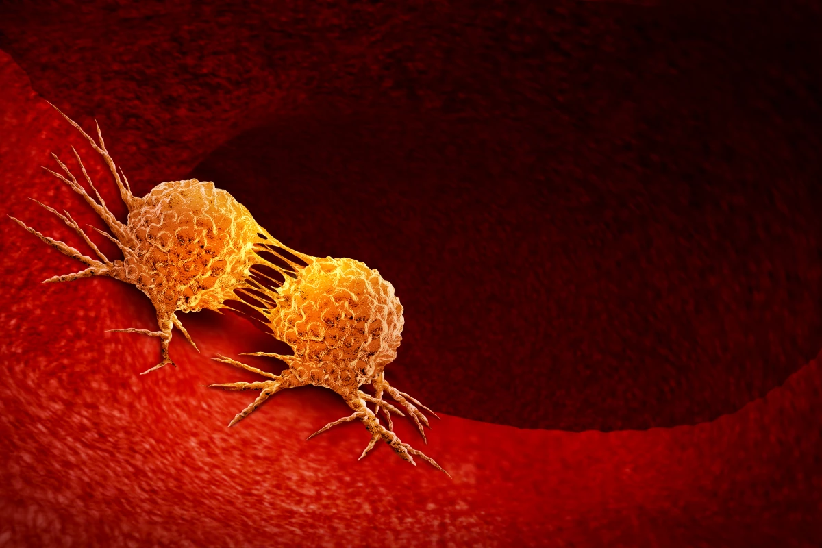 Men carrying the BRCA2 gene variant were twice as likely to develop prostate cancer compared to those without the mutation