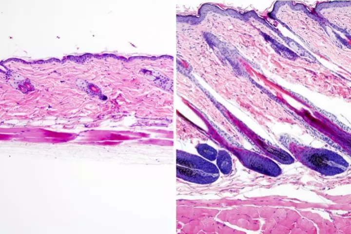 Untreated mouse skin on the left versus skin that was treated with the drug UK5099 on the right