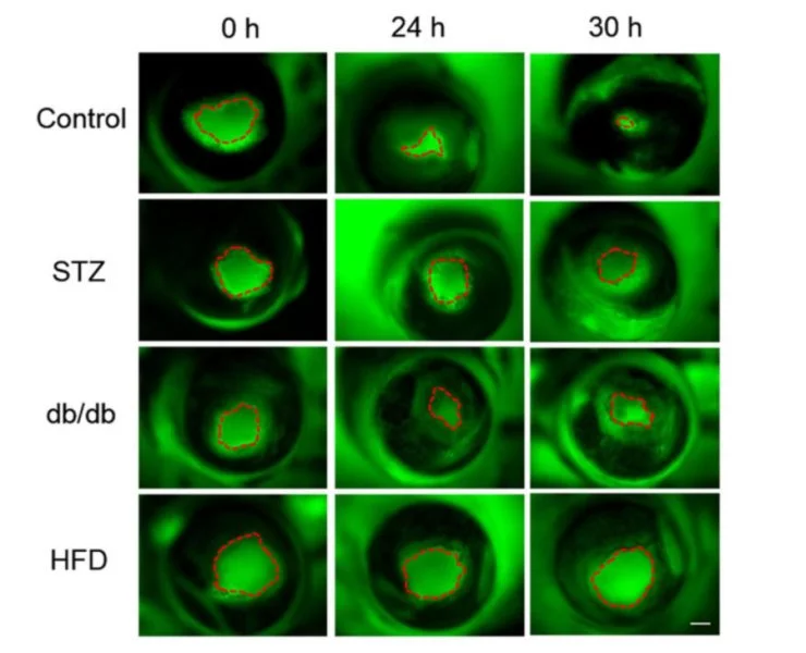 From left to right, the top row shows the wound shrinking in the cornea of a healthy mouse, while the lower rows show a lengthened healing process in a diabetic mouse