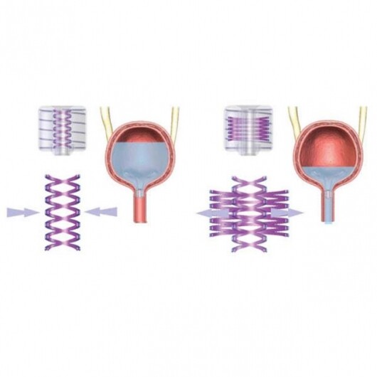 Remotecontrol bladder switch a relief for the incontinent