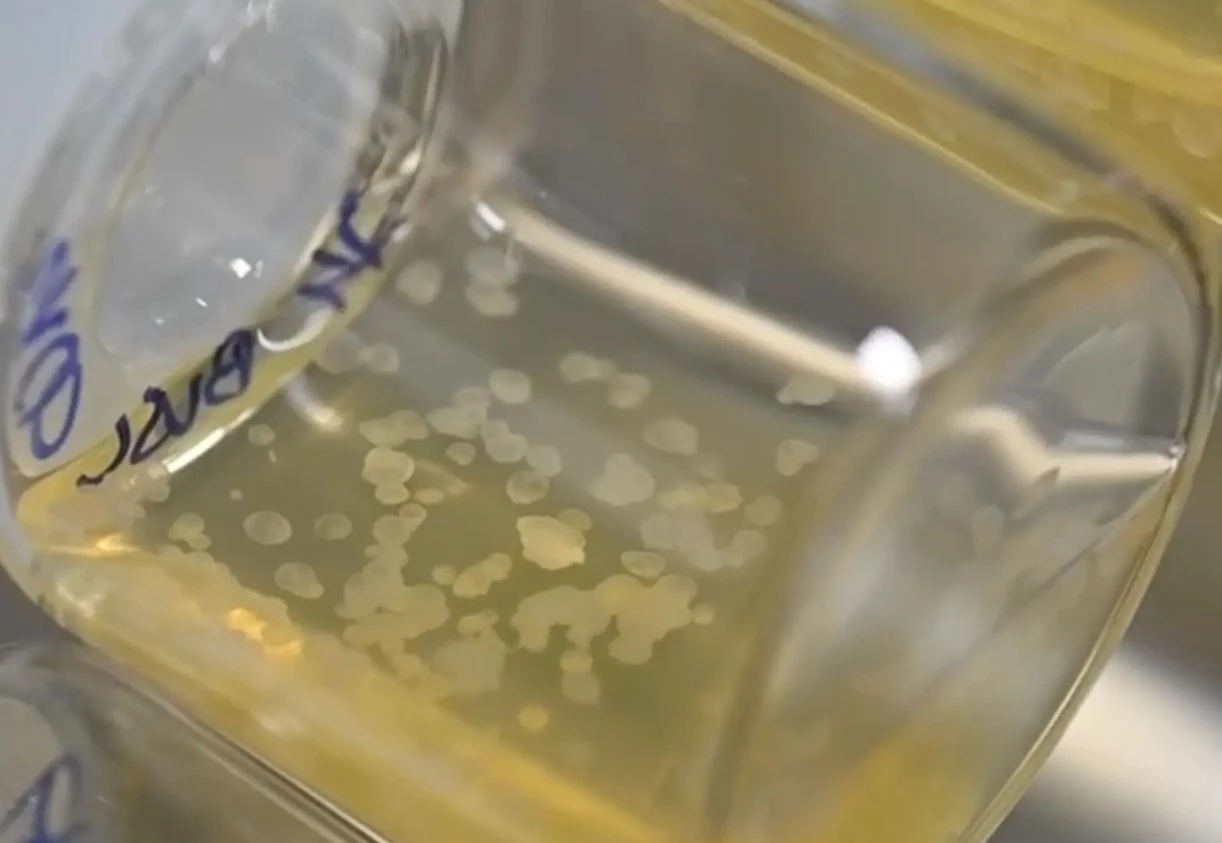A sample of the synthetic embryos in the nutrient solution