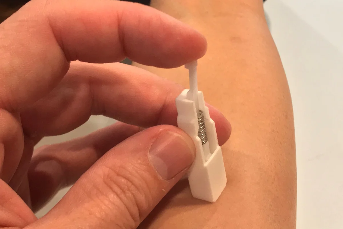 Professor Tarl Prow and his team have developed a prototype of a microbiopsy device, which can take skin cell samples to diagnose cancer painlessly and without leaving a scar
