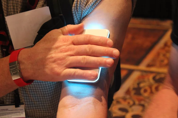 Want to know the quality and fat level of your muscles? Skulpt can tell you