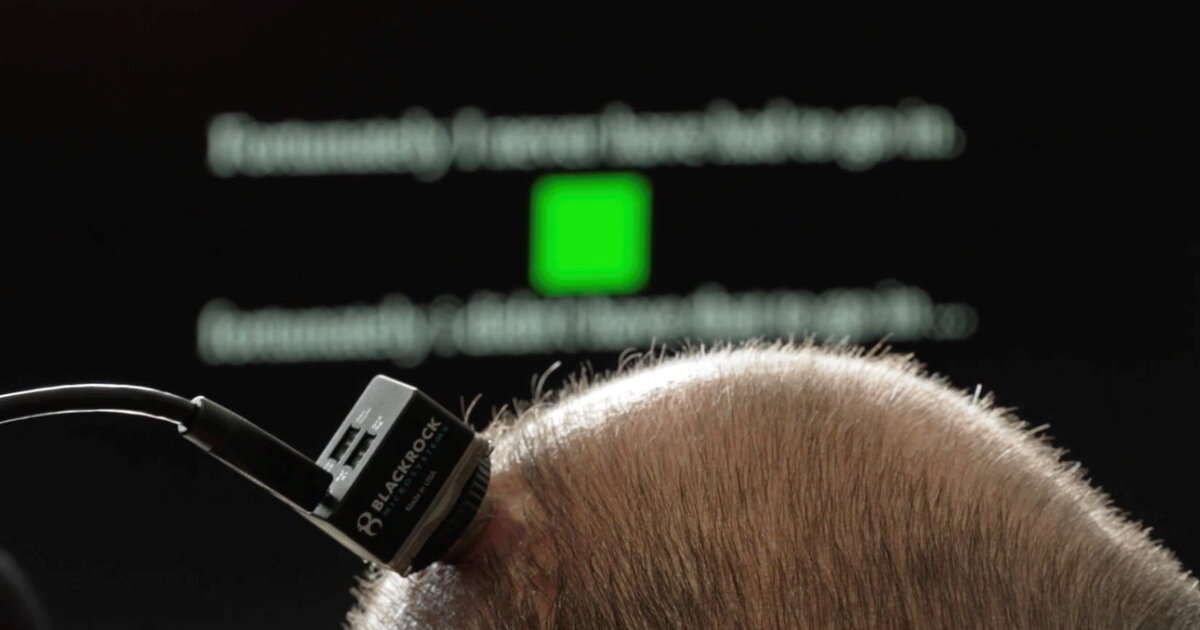 Brain implant breakthrough helps ALS man talk – and sing – again