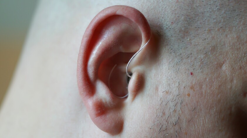 The devices fairly subtle in hear