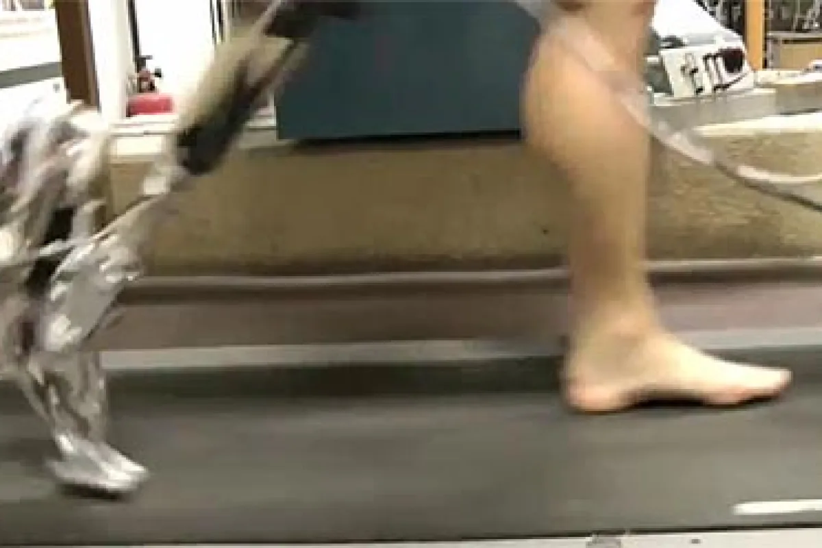 An amputee tests the AMP-Foot 2.0 on a treadmill