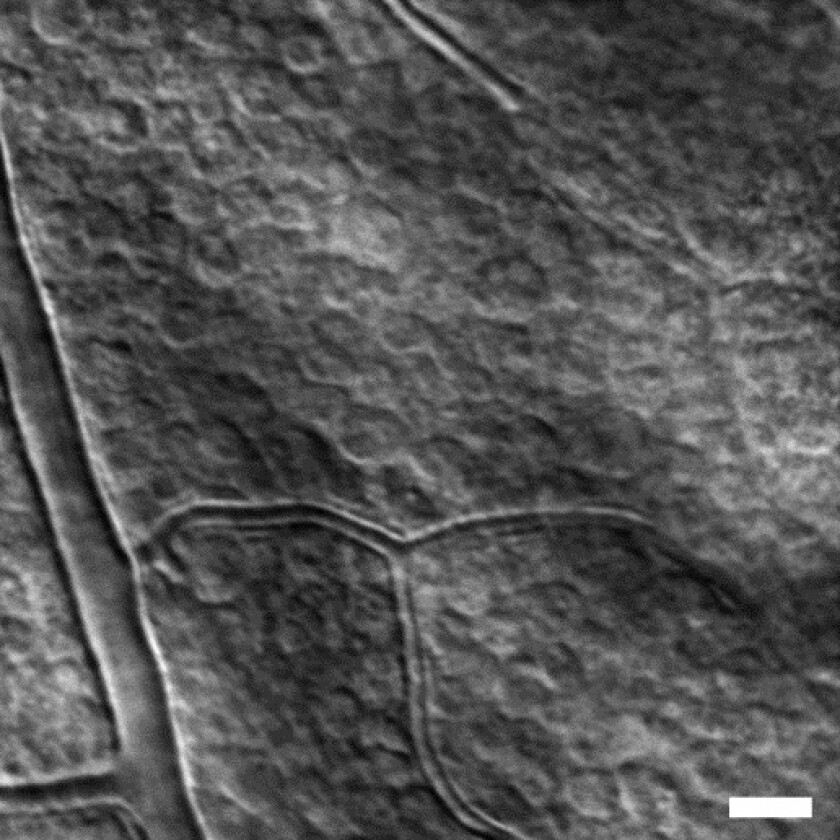 Retinal ganglion cells in the eye of a rhesus monkey