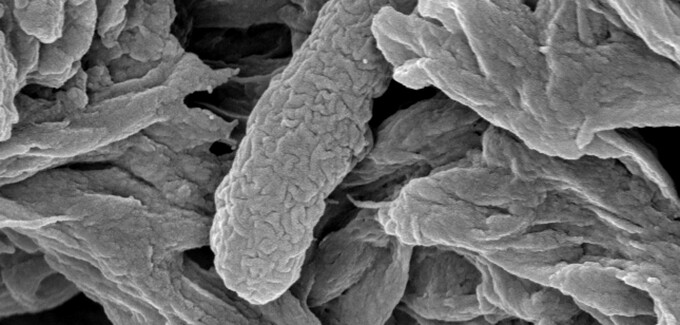 A dead E. coli bacterium collected in a filter after treatment with the Stanford nanoscavenger (Photo: Mingliang Zhang, Stanford School of Engineering)