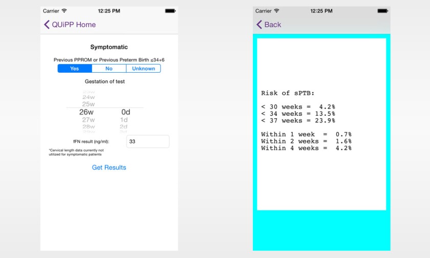 The researchers' algorithm is available via an iOS app known as QUiPP