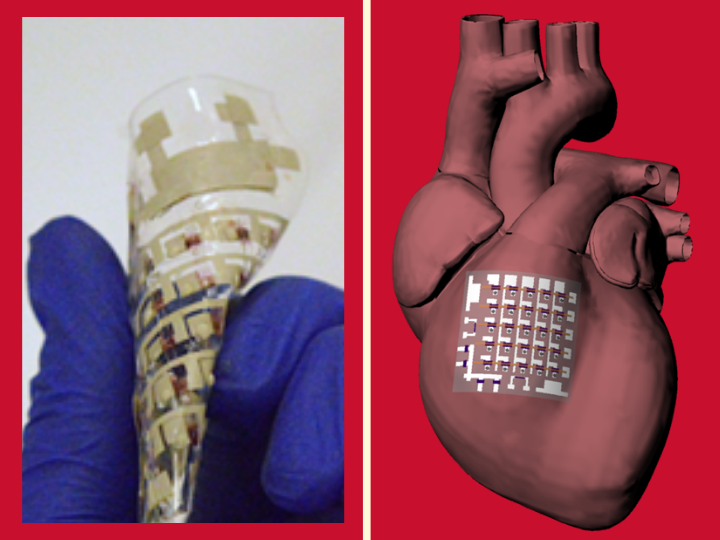 A newly developed sensing patch is pliable enough to be applied to a beating heart