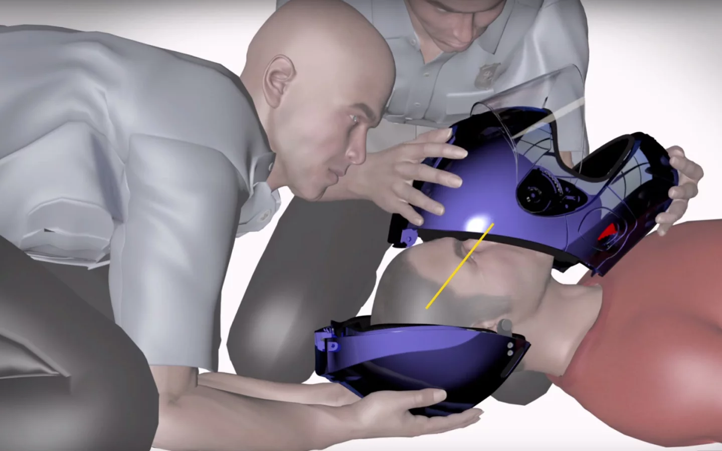 The Vozz Safety Release System requires a flat head screwdriver to separate the two parts of the helmet, making its removal possible without moving the neck or applying any pressure to the head